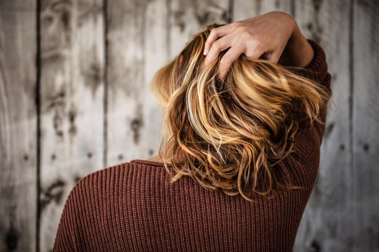 3 болезни, о которых «кричит» состояние ваших волос