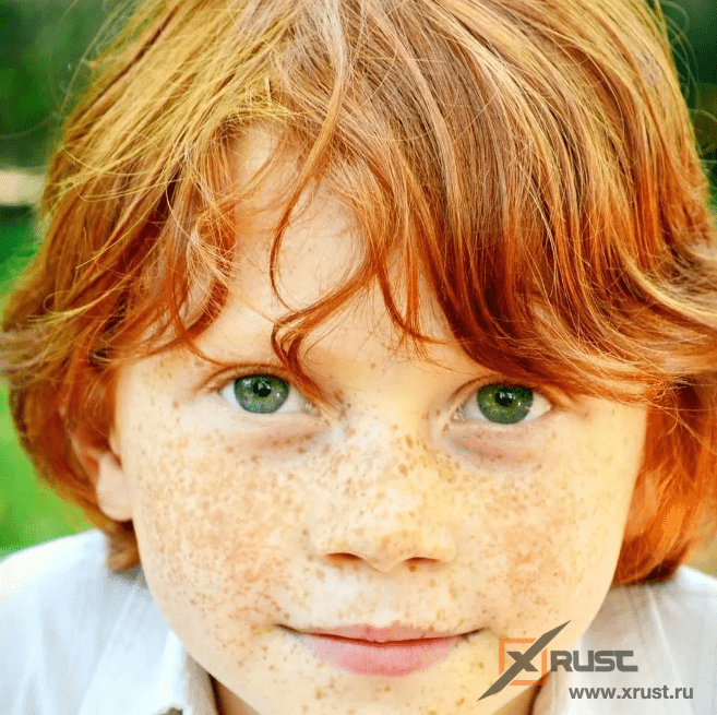 Самое редкое сочетание в мире: рыжие волосы и голубые глаза