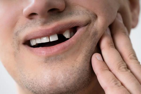 Минус зуб – почему нельзя оставить все, как есть? Чем грозит отсутствие зуба?